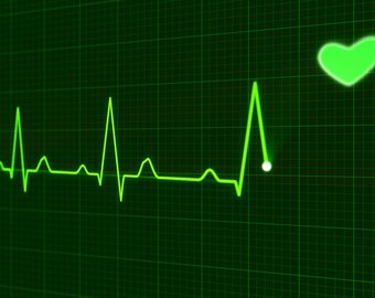 Medical diagnostic programme for cardiac arrhythmia (except for patients with cardiostimulator)